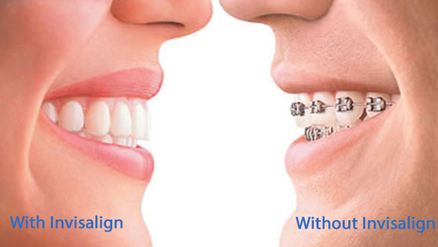 Mattituck Invisalign